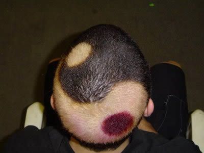 The world’s worst haircuts (20 photos)