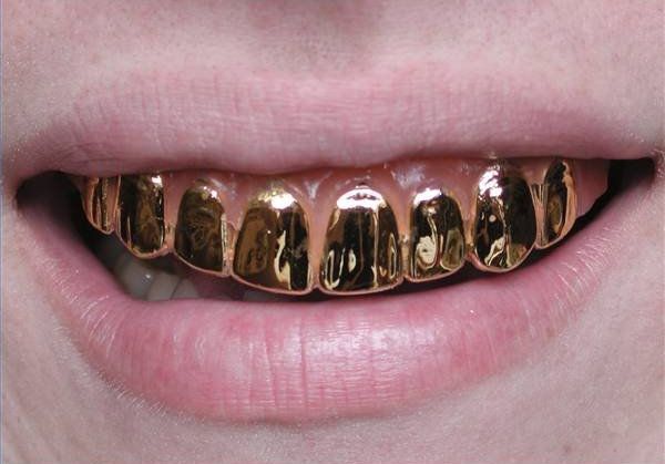They can do anything from gold nowadays (41 photos)
