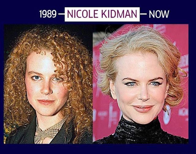 Stars can’t get old and they will do whatever it takes to stay young (6 photos)