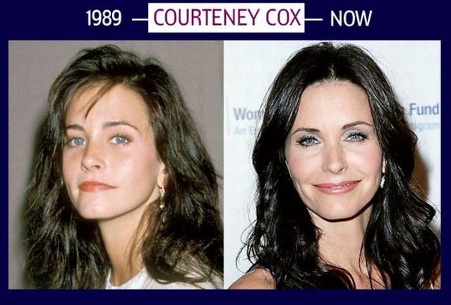 Stars can’t get old and they will do whatever it takes to stay young (6 photos)