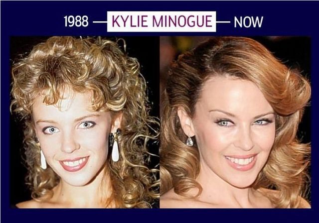Stars can’t get old and they will do whatever it takes to stay young (6 photos)