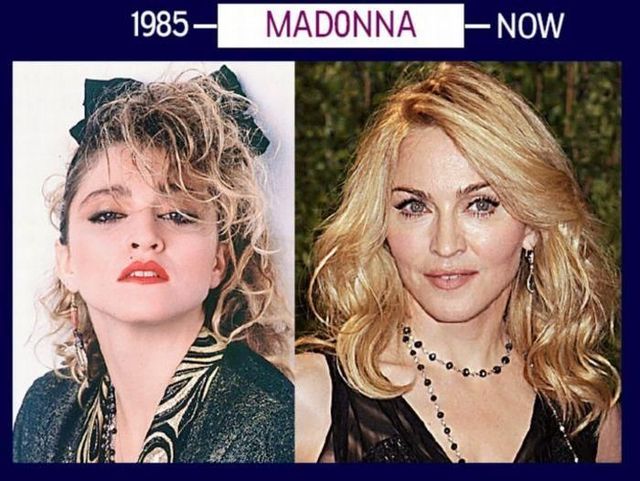 Stars can’t get old and they will do whatever it takes to stay young (6 photos)