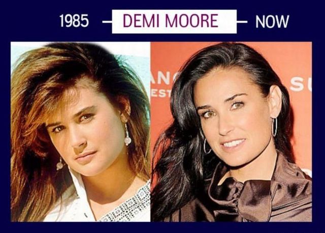 Stars can’t get old and they will do whatever it takes to stay young (6 photos)