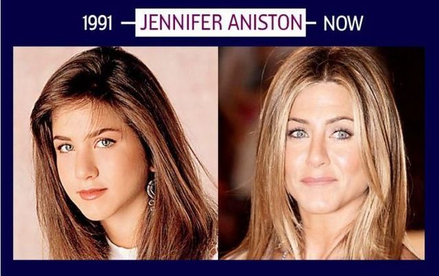 Stars can’t get old and they will do whatever it takes to stay young (6 photos)