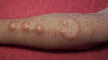 Body modification (25 photos)